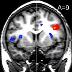 0311 04 fmri scan pricing