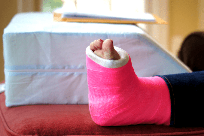 A person's leg with a bright pink cast resting on a red cushion with a portable lap desk in the background.