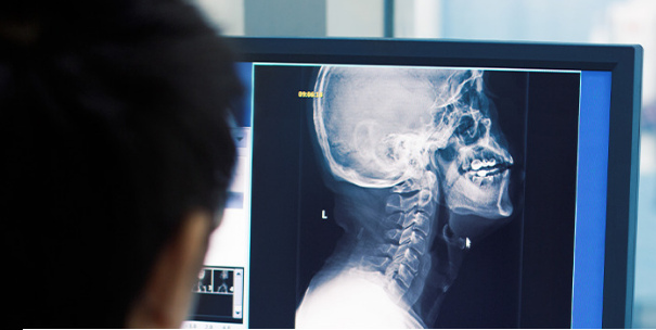 A person is viewing an X-ray image of a human head and neck on a computer monitor.
