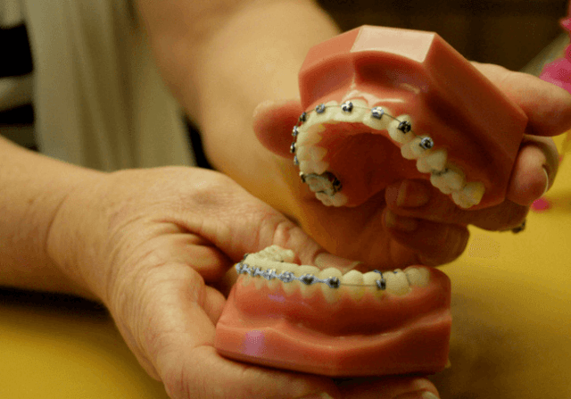Orthodontist with example mouth