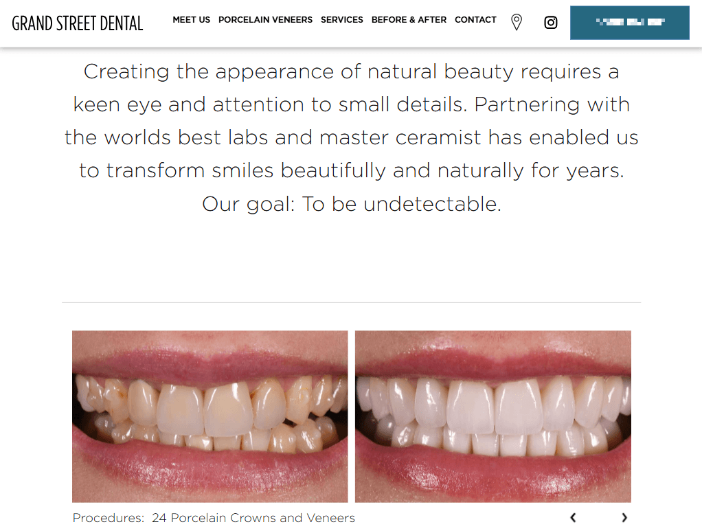 Example of a before-and-after page on a dental office’s website