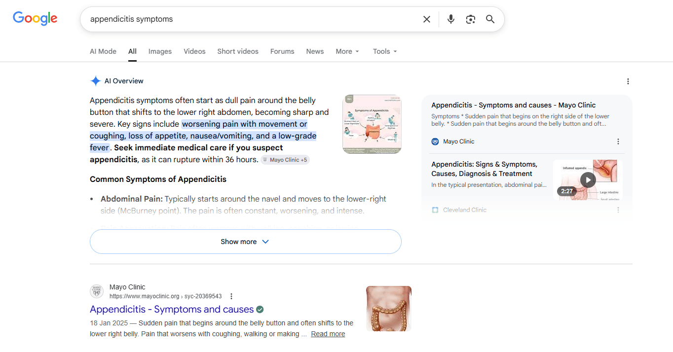 Mayo Clinic featured in AI Overview for appendicitis symptoms search query